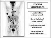 Figure 2 (Image 1) Staging Malignancy