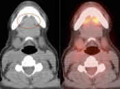 Case 3 (Image 1)