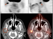 Case 4 (Image 1)