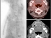 Case 1 (Image 1)