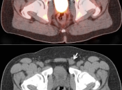 Case 2 (Image 1)