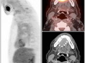 Case 3 (Image 1)