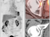 Case 3 (Image 1)