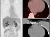 Case 1 (Image 1)
