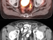 Case 4 (Image 1)