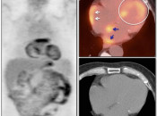 Case 4 (Image 1)
