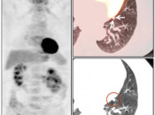 Case 5 (Image 1)