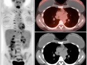 Case 2 (Image 1)