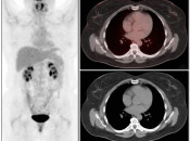 Case 3 (Image 1)