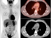 Case 5 (Image 1)