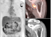 Case 5 (Image 1)