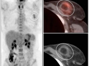 Case 7 (Image 1)