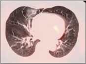 Case 2 (Image 1)