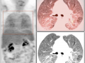 Case 3 (Image 1)