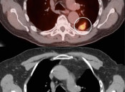 Case 4 (Image 1)