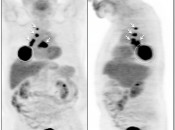 Case 5 (Image 1)