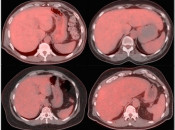 Case 1 (Image 1)