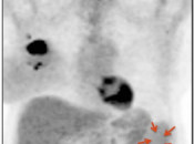 Case 2 (Image 1)