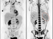 Case 4 (Image 1)