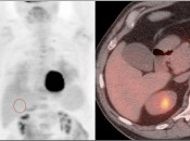 Case 1 (Image 1)