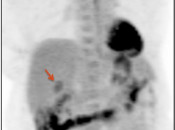 Case 2 (Image 1)