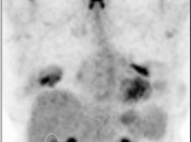 Case 3 (Image 1)