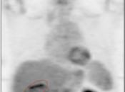 Case 4 (Image 1)