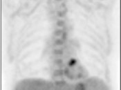 Case 5 (Image 1)