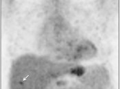 Case 6 (Image 1)