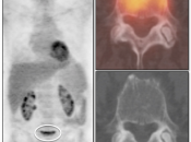 Case 3 (Image 1)