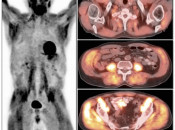 Figure 1 (Image 1) poor patient prep