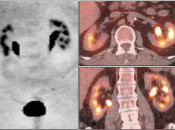 Case 1 (Image 1)