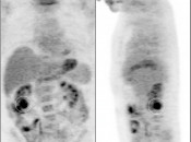 Case 2 (Image 1)