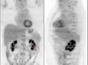 Case 3 (Image 1)