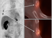Case 4 (Image 1)