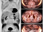 Figure 2 (Image 1) poor patient prep