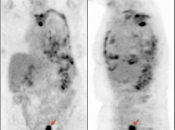 Case 2 (Image 1)