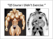 Figure 3 (Image 1) poor patient prep