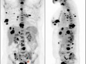 Case 3 (Image 1)