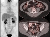 Case 1 (Image 1)
