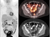 Case 2 (Image 1)
