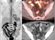Case 4 (Image 1)