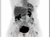 Case 1 (Image 1)