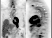 Case 4 (Image 1)