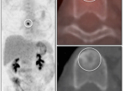 Case 1 (Image 1)