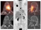 Case 2 (Image 1)