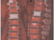 Case 2 (Image 1)