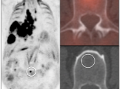 Case 3 (Image 1)