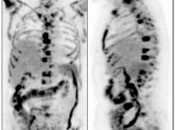 Case 4 (Image 1)