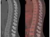 Case 1 (Image 1)